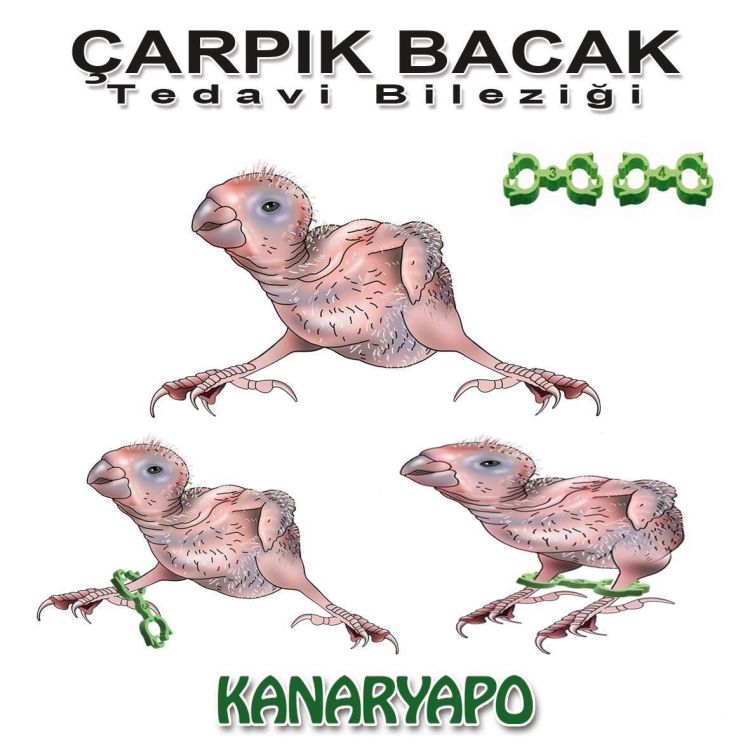 Kanaryapo Muhabbet Çarpık Bacak Bileziği X 3 Adet