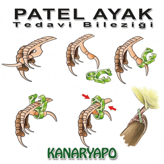 Kanaryapo Patel Ayak Tedavi Bileziği Seti 8li x 3 Adet - Thumbnail