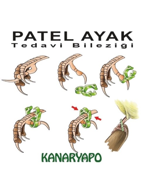 Kanaryapo Patel Ayak Tedavi Bileziği Seti 8'li Set - Thumbnail